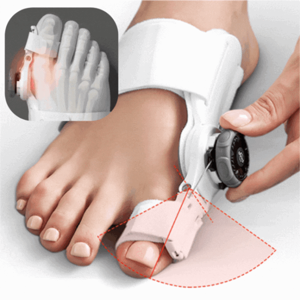 مصحح لأصابع القدم Bunion Corrector Relief Orthopedic Splint