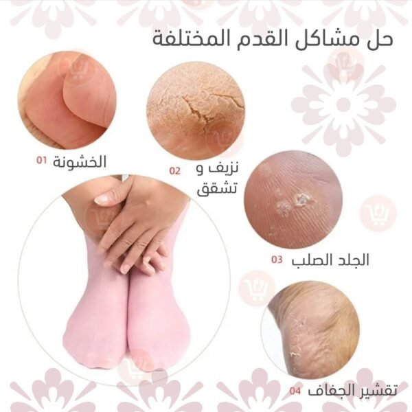جوارب سيليكون للترطيب والعلاج
