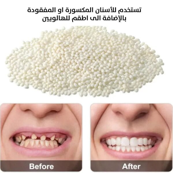 معجون حشوات الراتنج للأسنان moldable false teeth