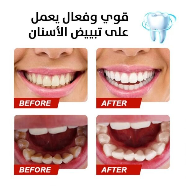 معجون تبيض الأسنان الفعال stain removal toothpaste