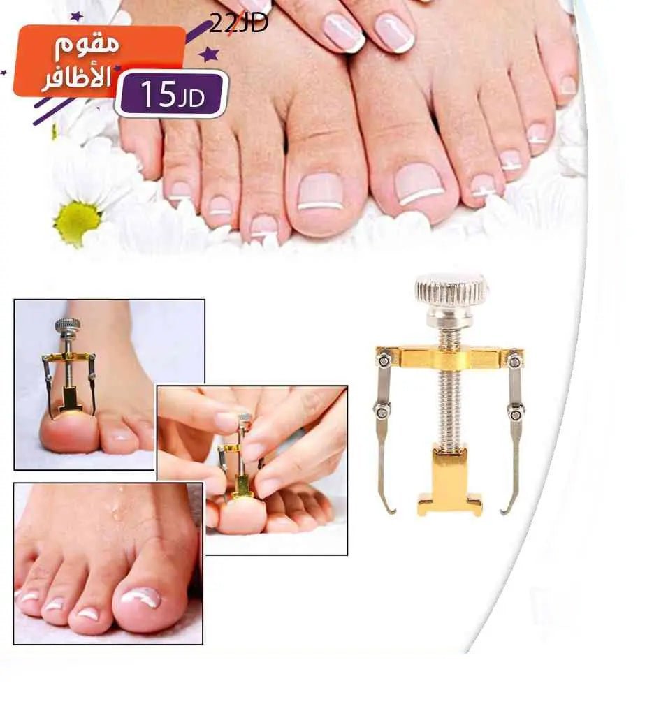 مقوم الأظافر Ingrown Toe Nail Fixer Device