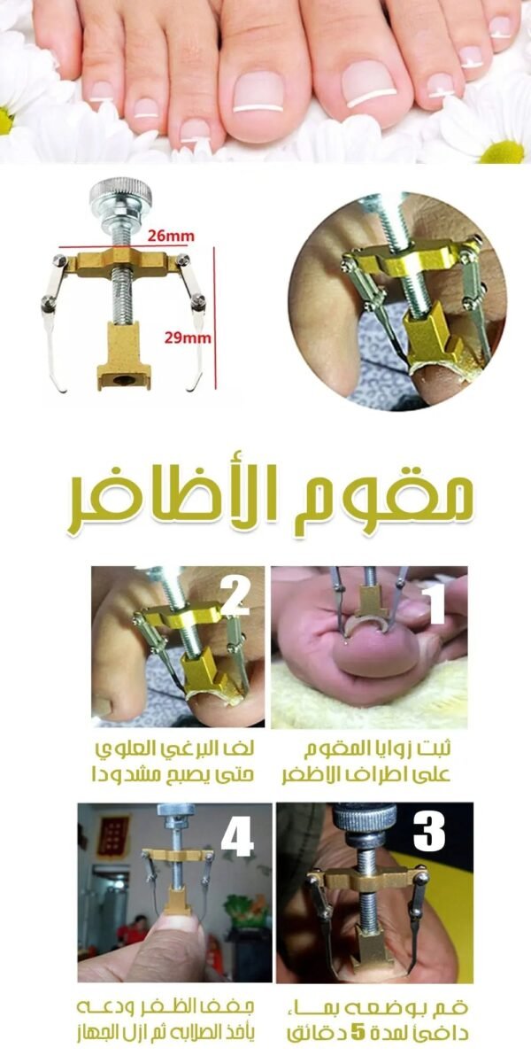 مقوم الأظافر Ingrown Toe Nail Fixer Device