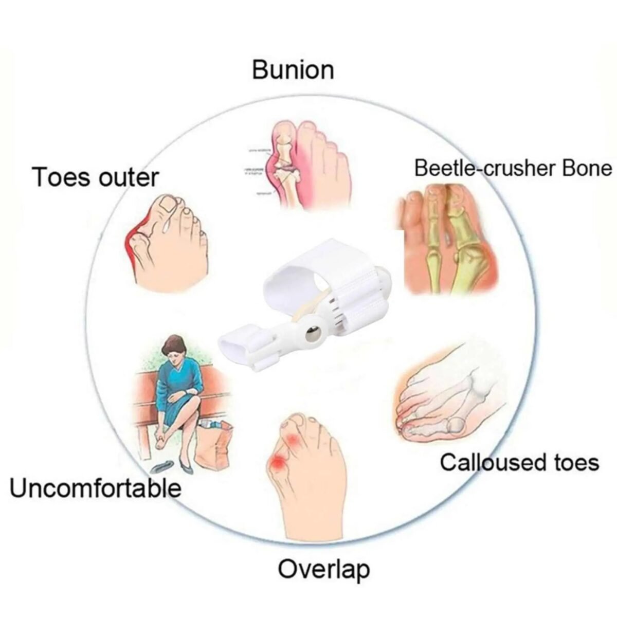 مصحح لأصابع القدم Bunion Corrector Relief Orthopedic Splint